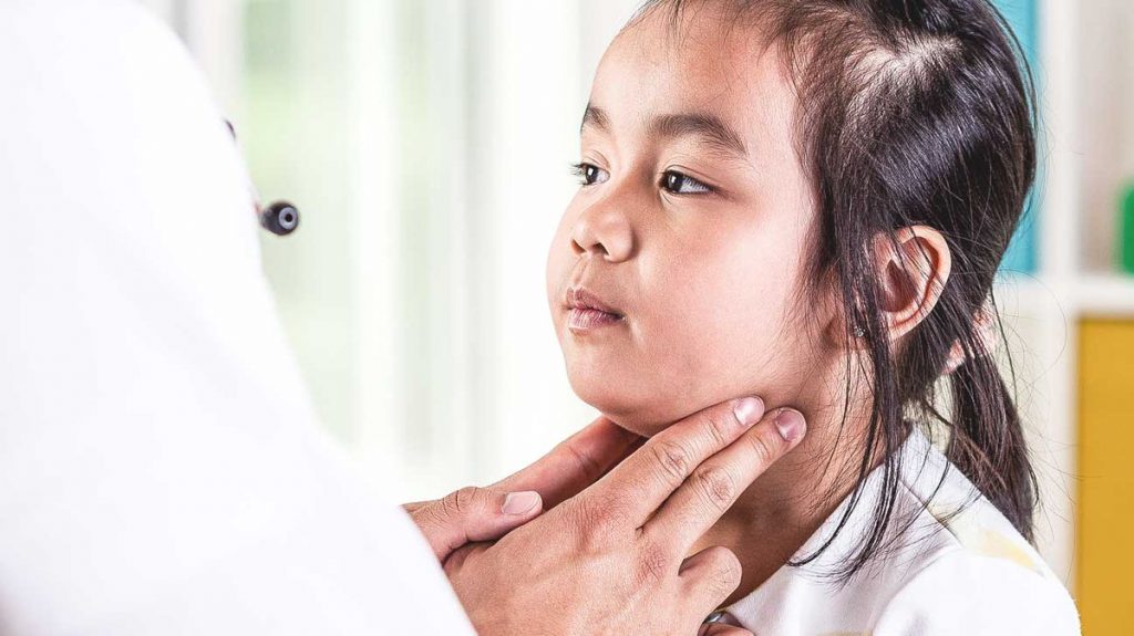 Người mắc bệnh quai bị kiêng những gì?